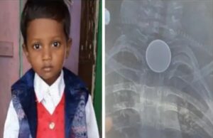 कोरबा में रहस्यमयी मौत 8 वर्षीय बच्चे की मौत से मचा हड़कंप गले में सिक्का फंसे होने का दावा लेकिन पोस्टमार्टम में नहीं मिला सिक्का